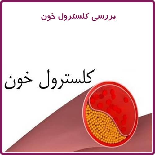 چگونگی بررسی کلسترول