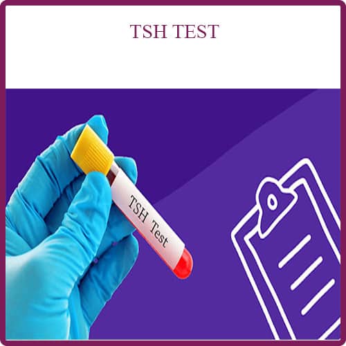 تفسیر و نتیجه آزمایش TSH تیروئید