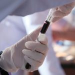 تأثیر سبک زندگی بر نتایج آزمایش خون: آنچه باید بدانید